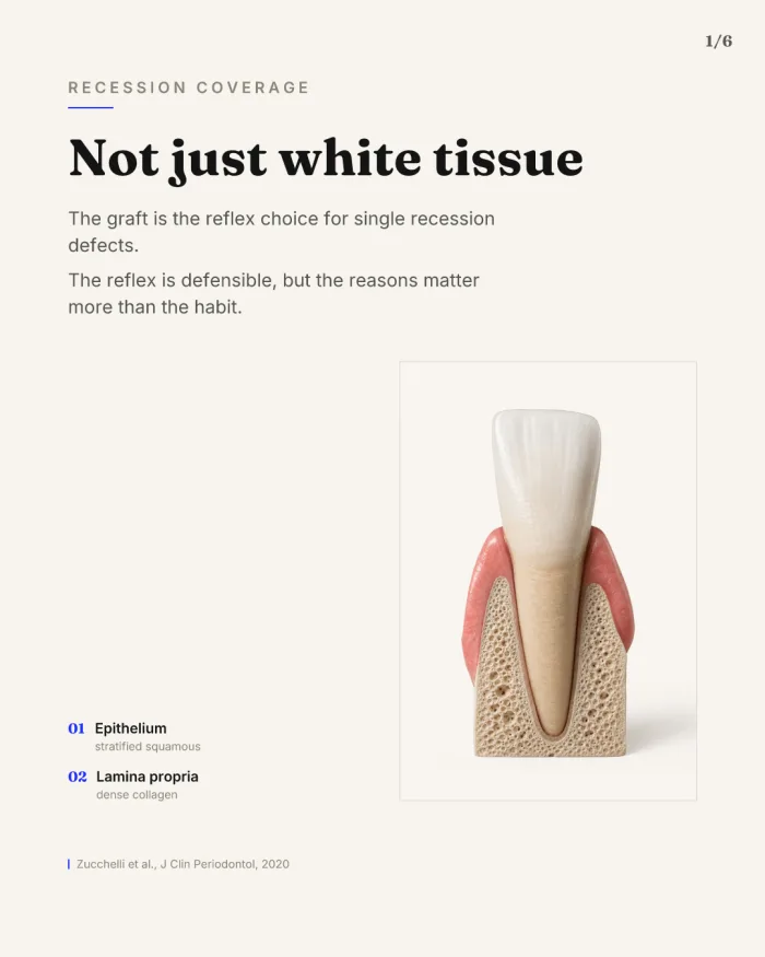 A carousel slide made with Carousel Studio: recession coverage, not just white tissue.