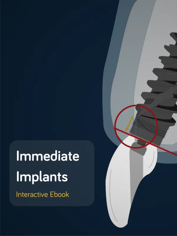 Immediate Implants interactive ebook cover.