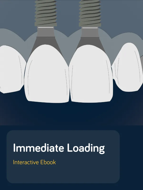 Immediate Loading interactive ebook cover.